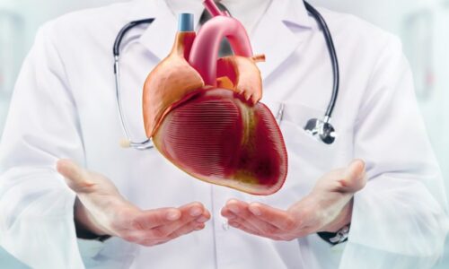 Karotis Arter Hastalığı